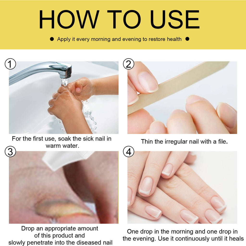 Ginseng Nail Essential Oil Grey Nail Thickening Nail Repair Brightening Nail Removing Soft Nail Moisturizing Essence