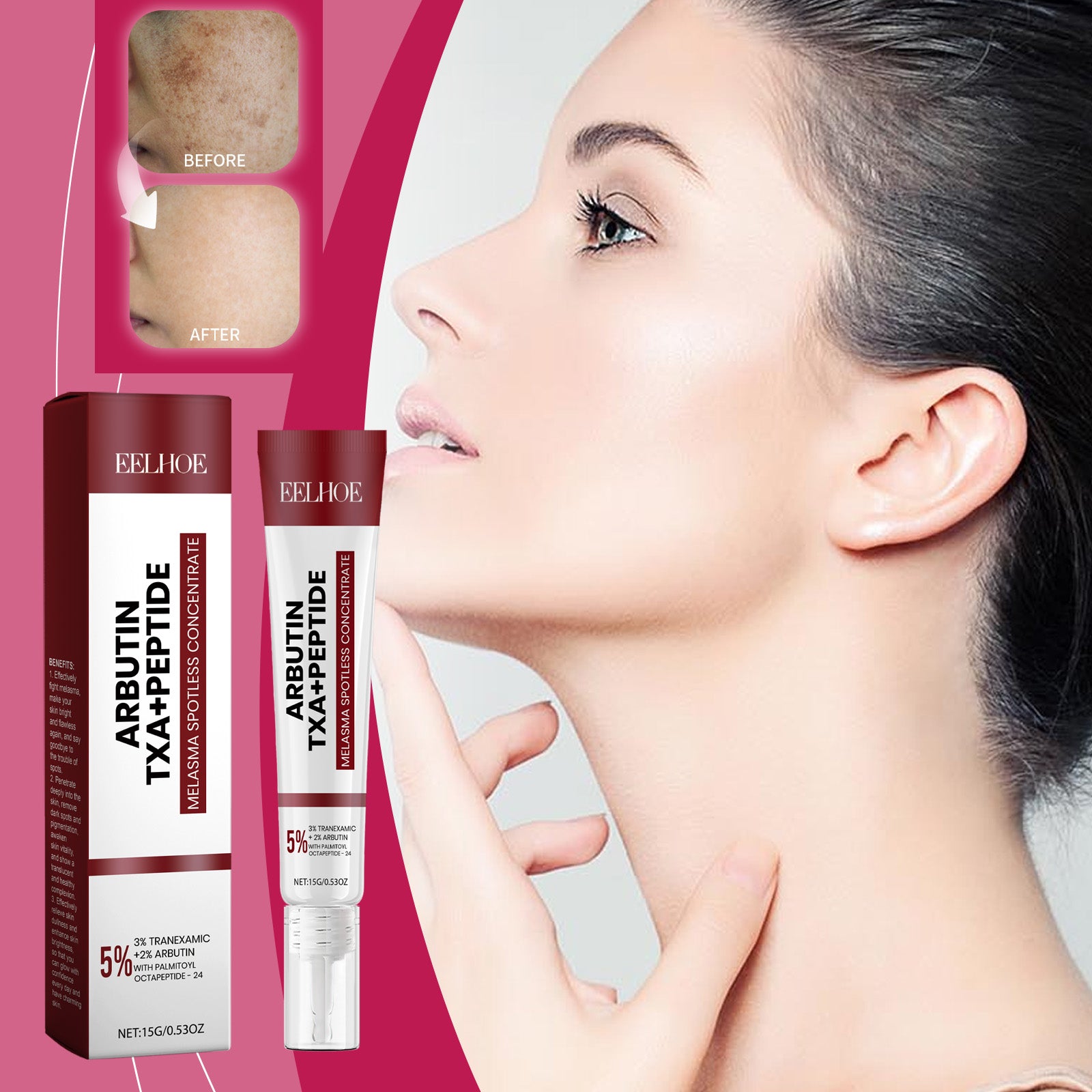 Melasma Spotless Concentrate, Moisturizing Firming Skin Refreshing And Dark Spots Skin Creams