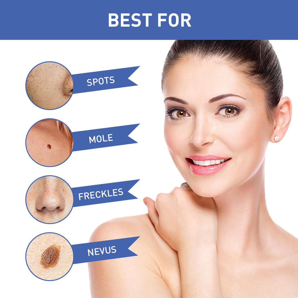 Warts Remover Cream, Body Skin Gram Wart Mole Meat Ball Wart Gentle Clean Smooth Skin