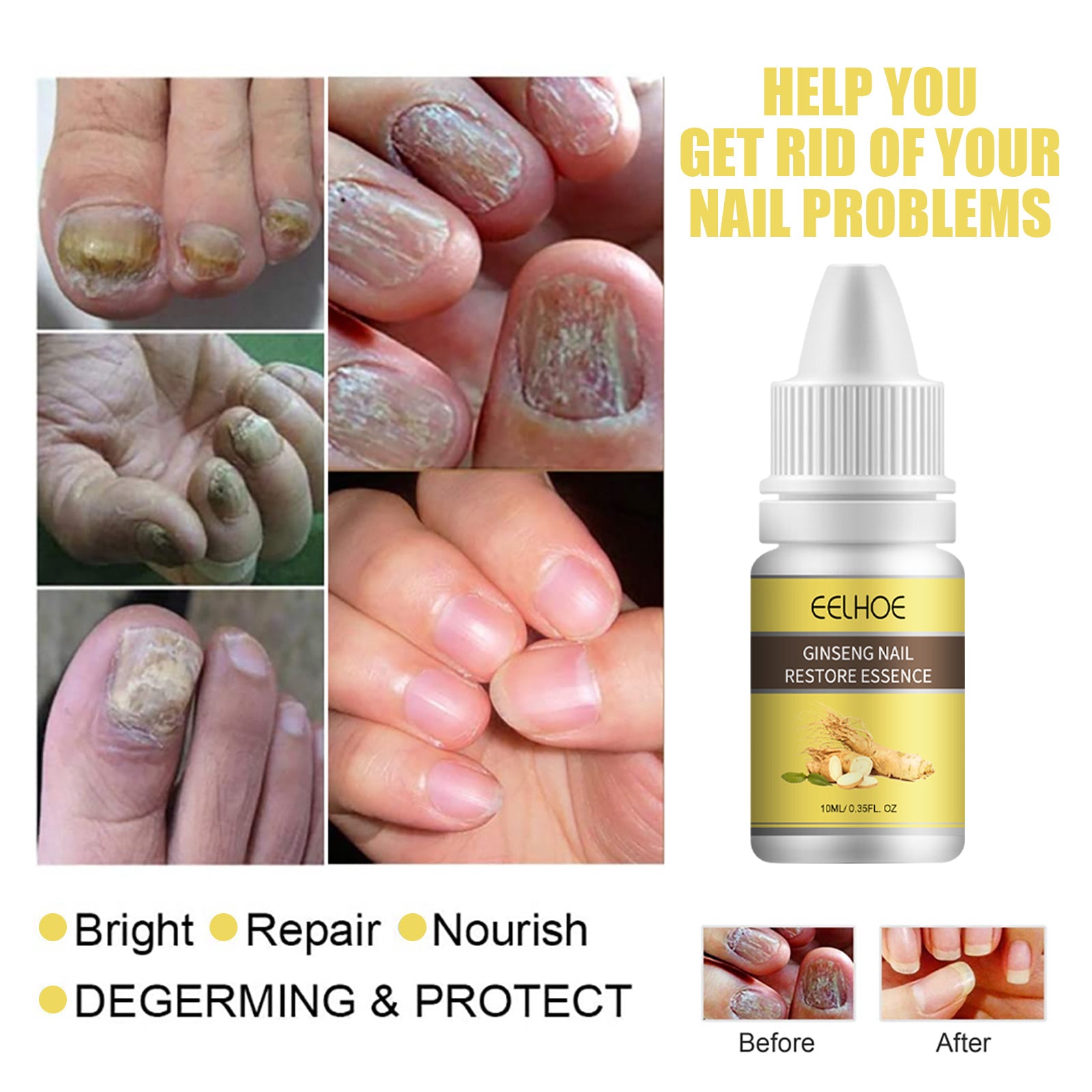 Ginseng Nail Essential Oil Grey Nail Thickening Nail Repair Brightening Nail Removing Soft Nail Moisturizing Essence