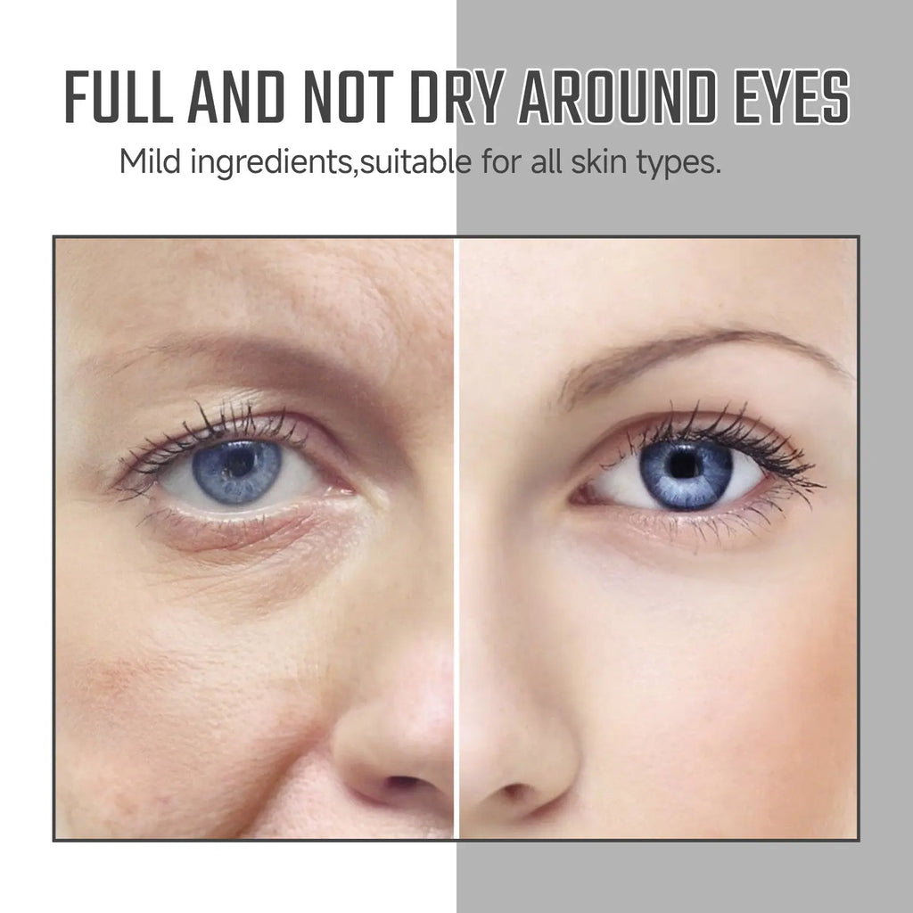 Instant Eye Care Essence Reduces Wrinkles And Dark Circles, Brightens Skin, And Moisturizes The Skin Around The Eyes eprolo