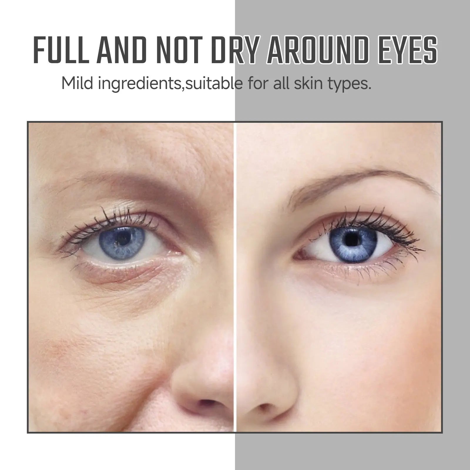 Instant Eye Care Essence Reduces Wrinkles And Dark Circles, Brightens Skin, And Moisturizes The Skin Around The Eyes eprolo