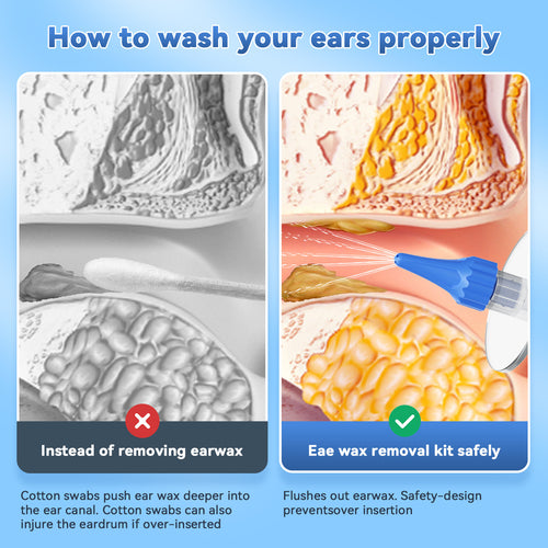 Earwax Cleaner Ear Cleaning Device Portable Home Use Ear Washer