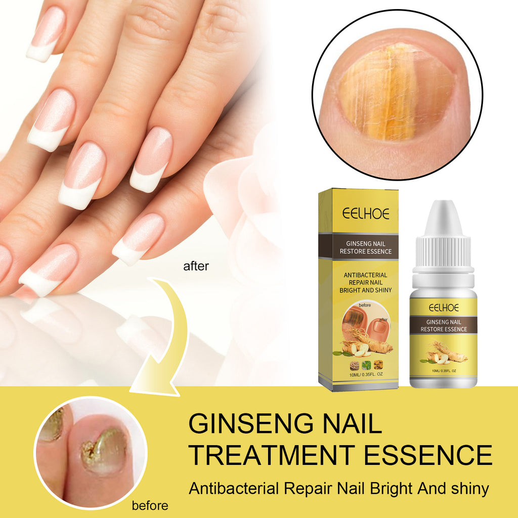Ginseng Nail Essential Oil Grey Nail Thickening Nail Repair Brightening Nail Removing Soft Nail Moisturizing Essence