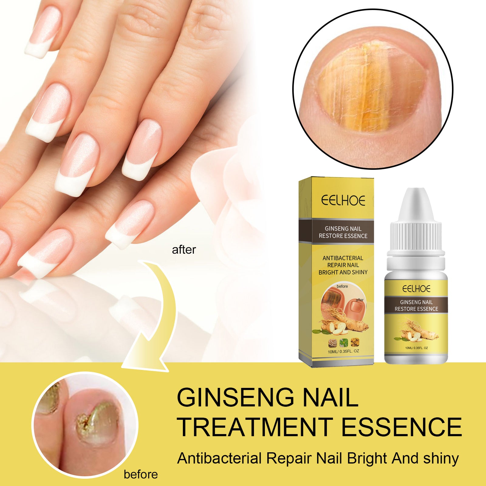 Ginseng Nail Essential Oil Grey Nail Thickening Nail Repair Brightening Nail Removing Soft Nail Moisturizing Essence
