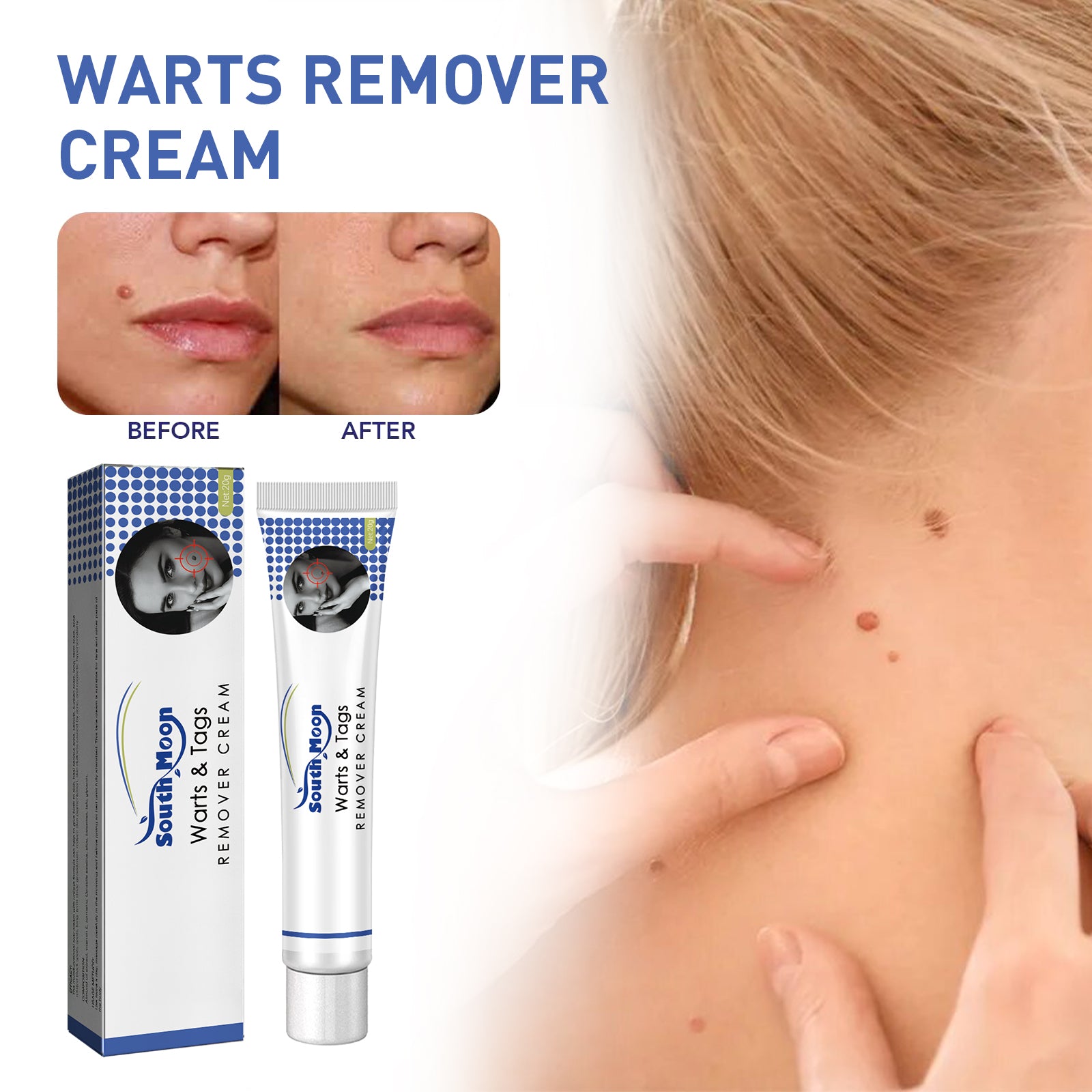 Warts Remover Cream, Body Skin Gram Wart Mole Meat Ball Wart Gentle Clean Smooth Skin