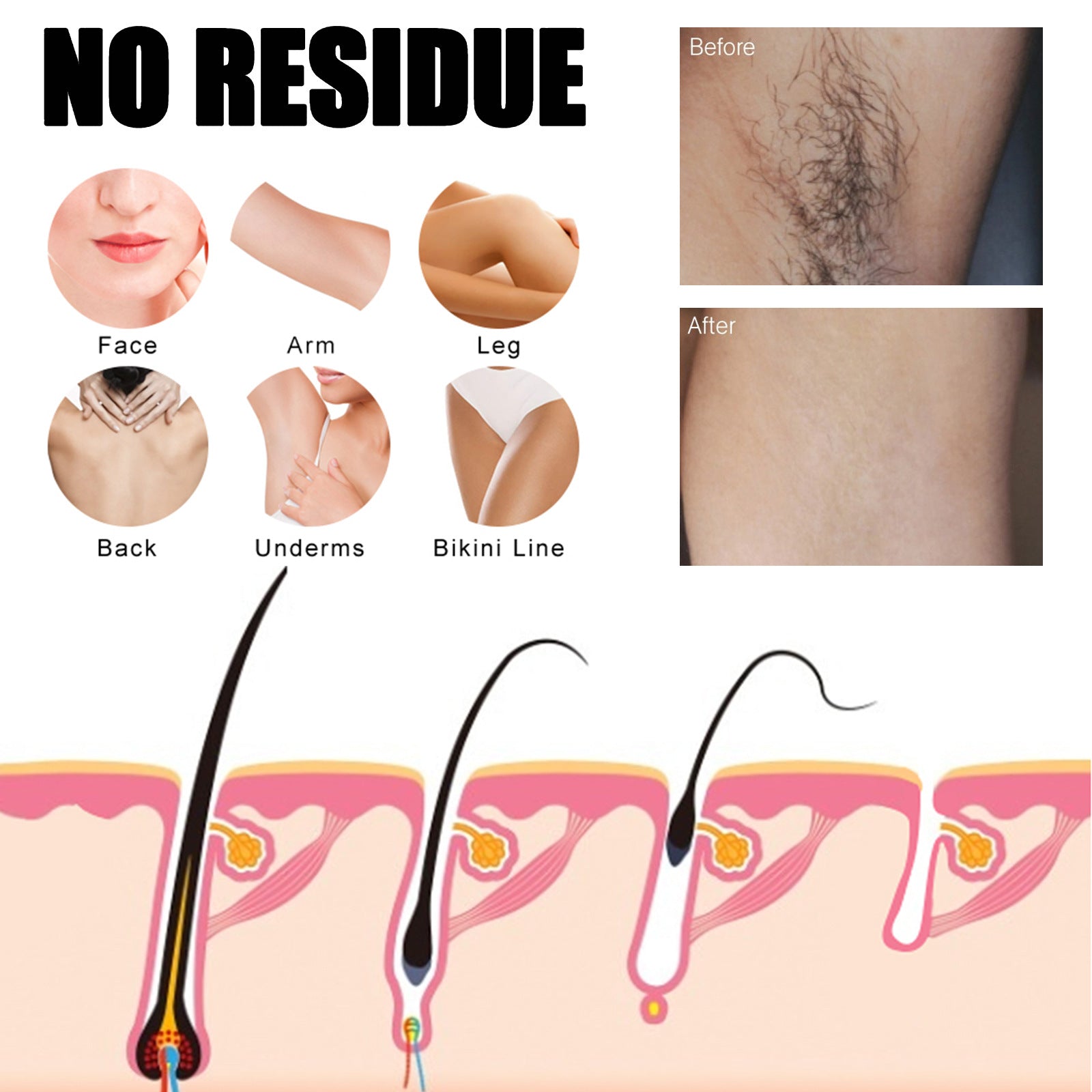 Underarm Refreshing Hair Removal Spray Underarm Gentle Hair Removal Spray Does Not Stimulate Fine Smooth Hair Removal eprolo