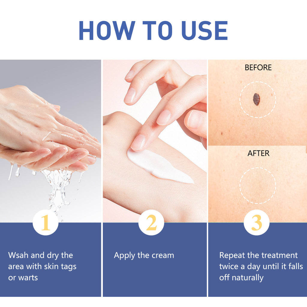 Warts Remover Cream, Body Skin Gram Wart Mole Meat Ball Wart Gentle Clean Smooth Skin